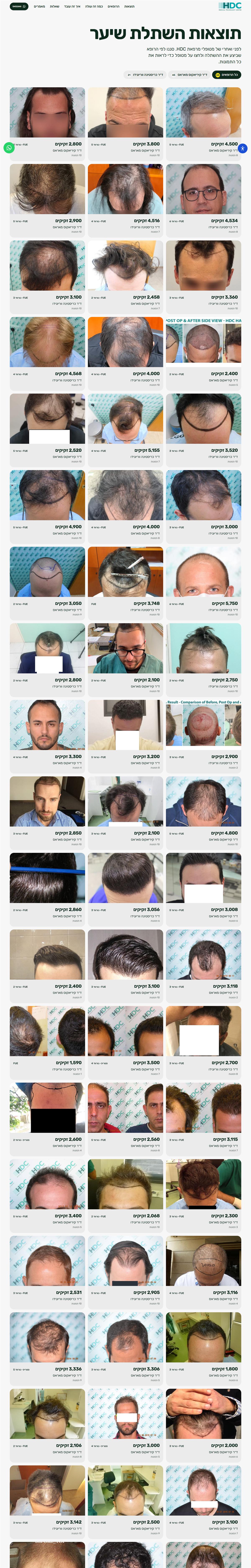HDC Hair Clinic website, full page capture 2